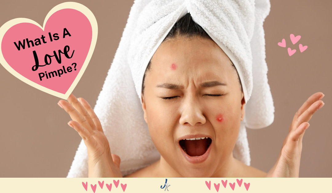 Love Pimples: What They Are and How To Treat Them