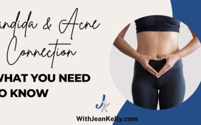 Candida & Acne Connection: What You Need To Know