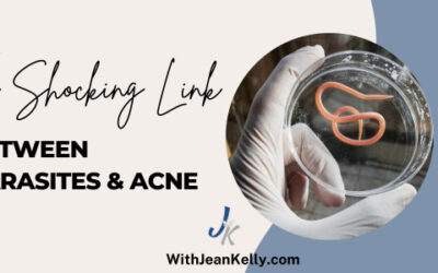 The Shocking Link Between Parasites And Acne