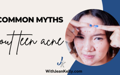 4 Common Myths About Teen Acne
