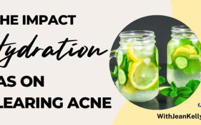 The Impact Hydration Has on Clearing Acne