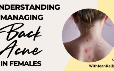 Understanding and Managing Back Acne in Females