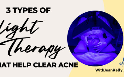 Three Types of Light Therapy That Help Clear Acne