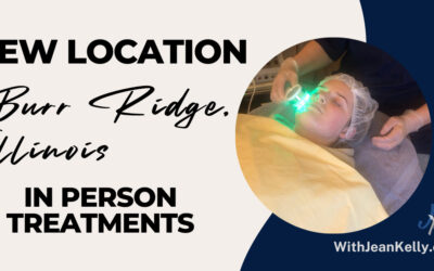 Acne Treatments – Now Open In Burr Ridge, Illinois