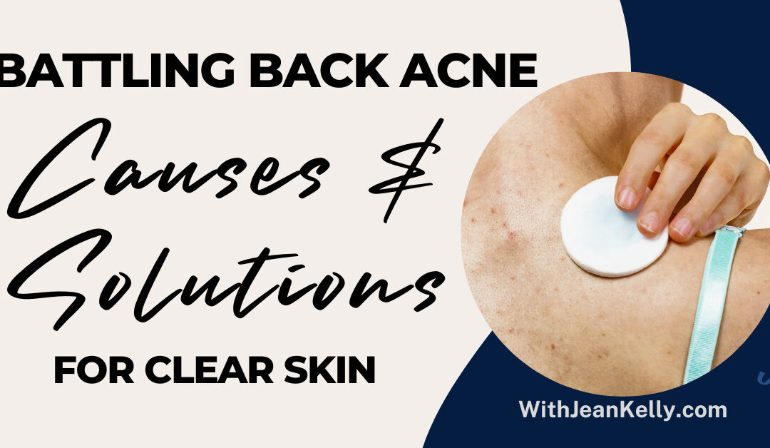 Battling Back Acne: Causes and Solutions for Clear Skin