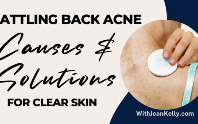 Battling Back Acne: Causes and Solutions for Clear Skin