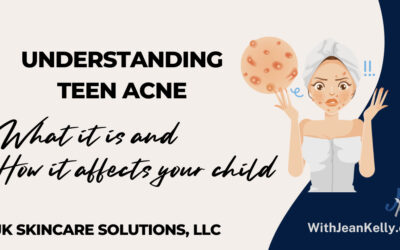 Understanding Teen Acne: What It Is and How it affects Your Child