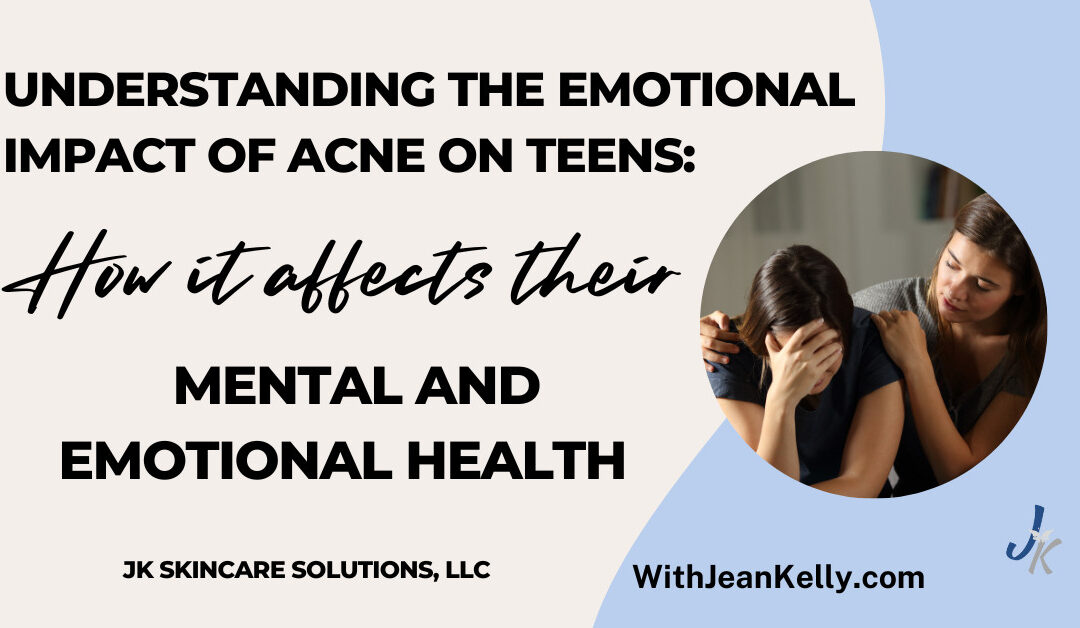 How Acne Affects A Teens Mental and Emotional Health