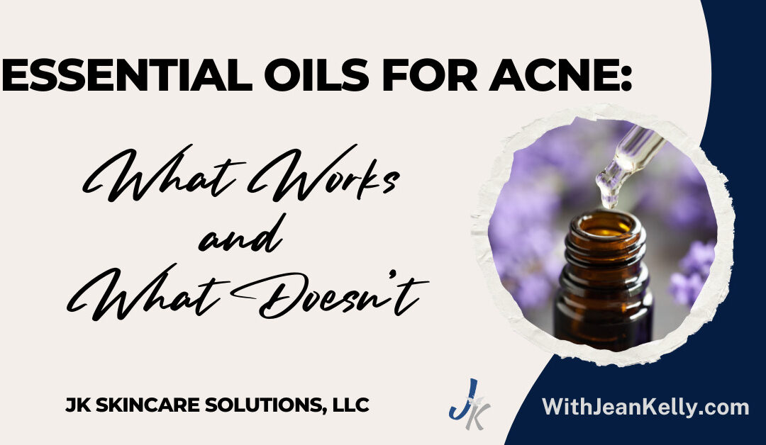 Essential Oils for Acne: What Works and What Doesn’t?