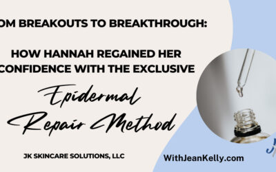 From Breakouts to Breakthrough: How Hannah Regained Her Confidence with the Epidermal Repair Method