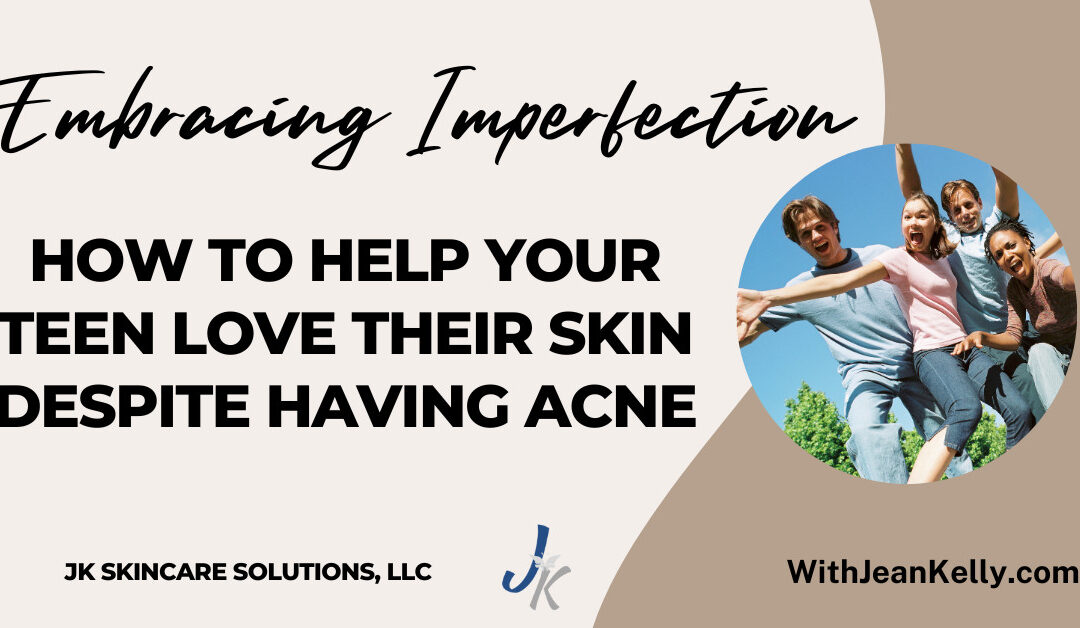 Embracing Imperfection: How to Help Your Teen Love Their Skin Despite Acne