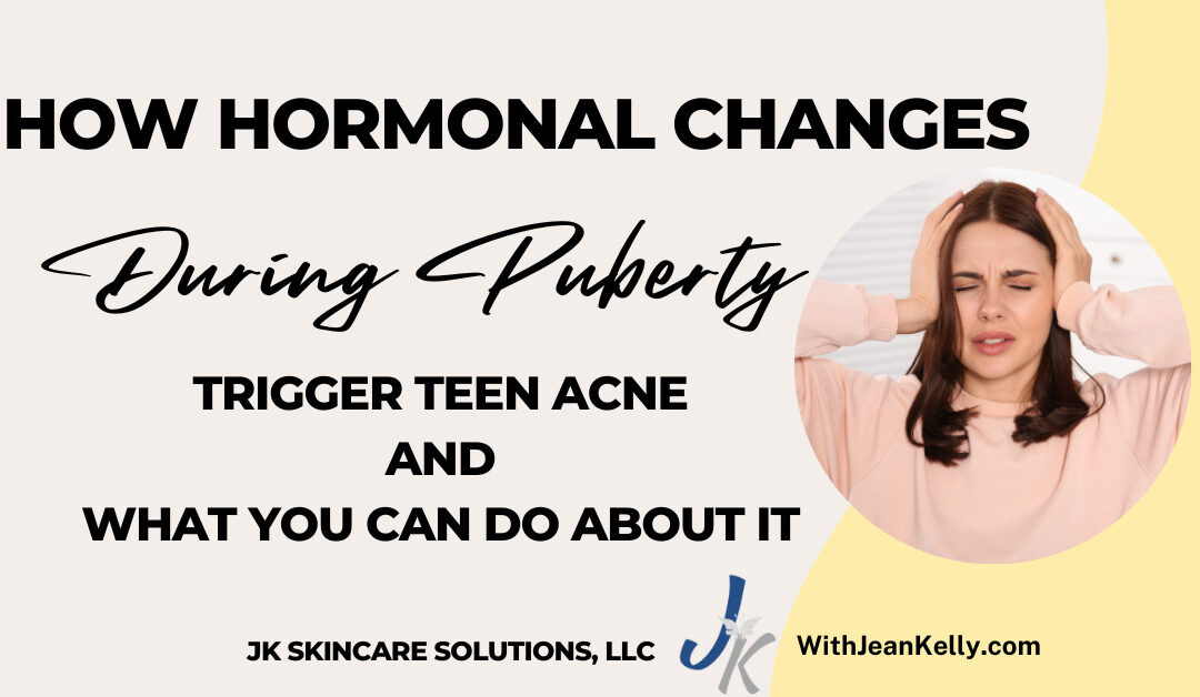 How Hormonal Changes During Puberty Trigger Teen Acne and What You Can Do About It