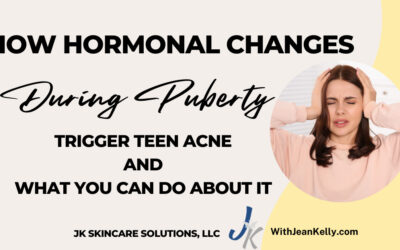 How Hormonal Changes During Puberty Trigger Teen Acne and What You Can Do About It