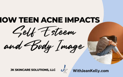 How Teen Acne Impacts Self-Esteem and Body Image