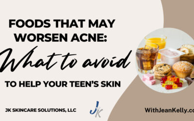 Foods That May Worsen Acne: What to Avoid to Help Your Teen’s Skin