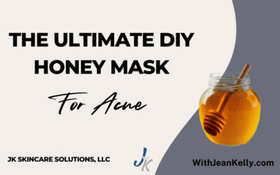 The Ultimate DIY Honey Mask for Acne