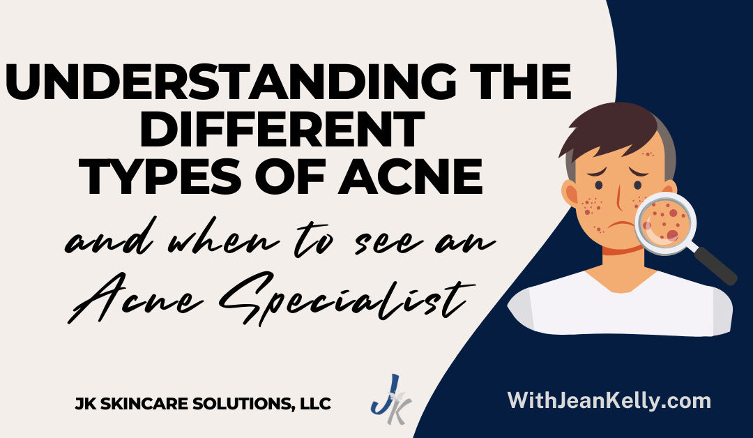 Understanding the Different Types of Acne and When to See an Acne Specialist