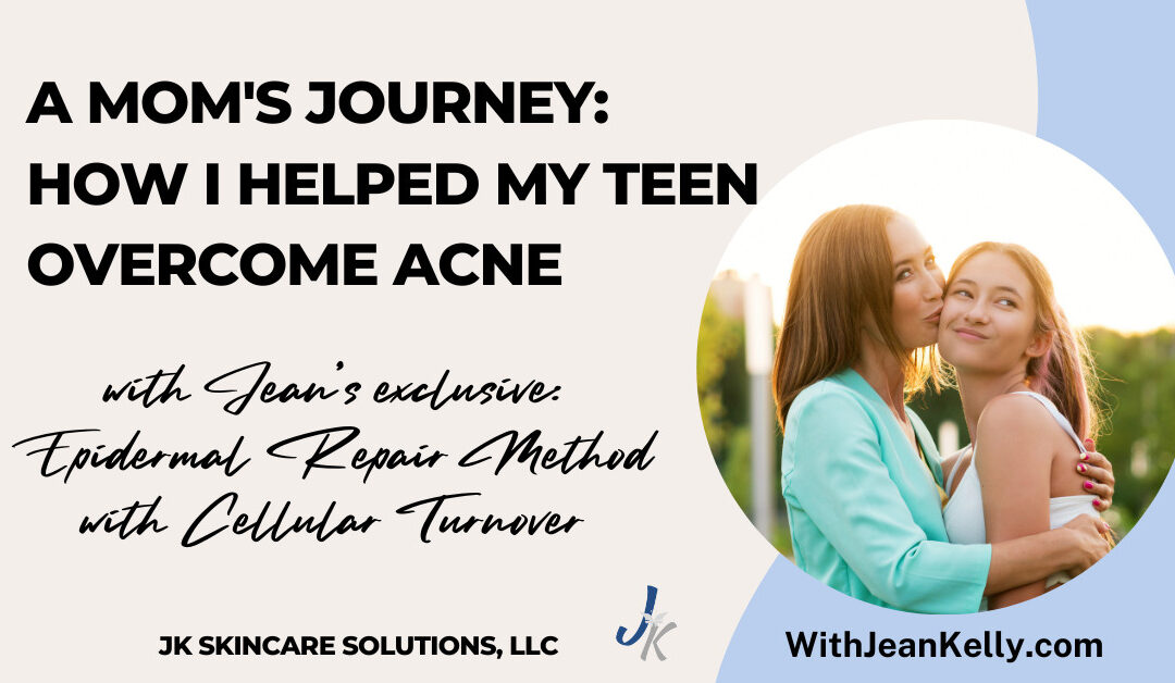 A Mom’s Journey: How I Helped My Teen Overcome Acne with the Epidermal Repair Method