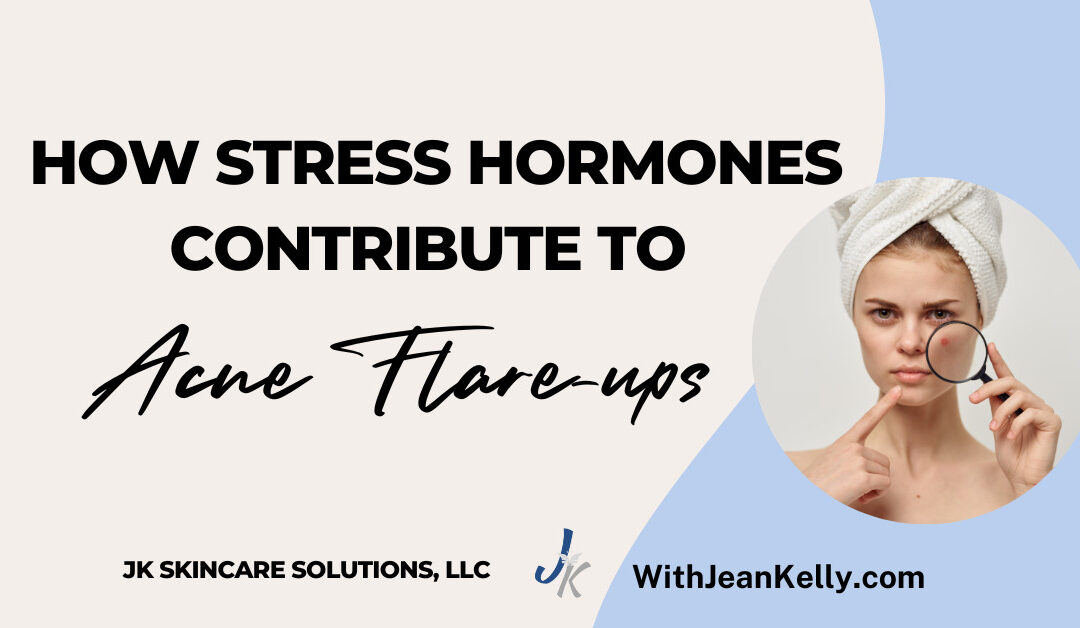 How Stress Hormones Contribute to Acne Flare-Ups