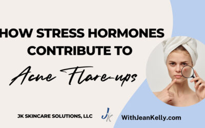 How Stress Hormones Contribute to Acne Flare-Ups