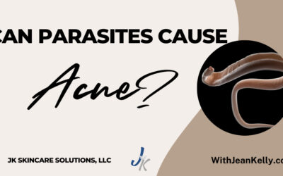 Can Parasites Cause Acne?