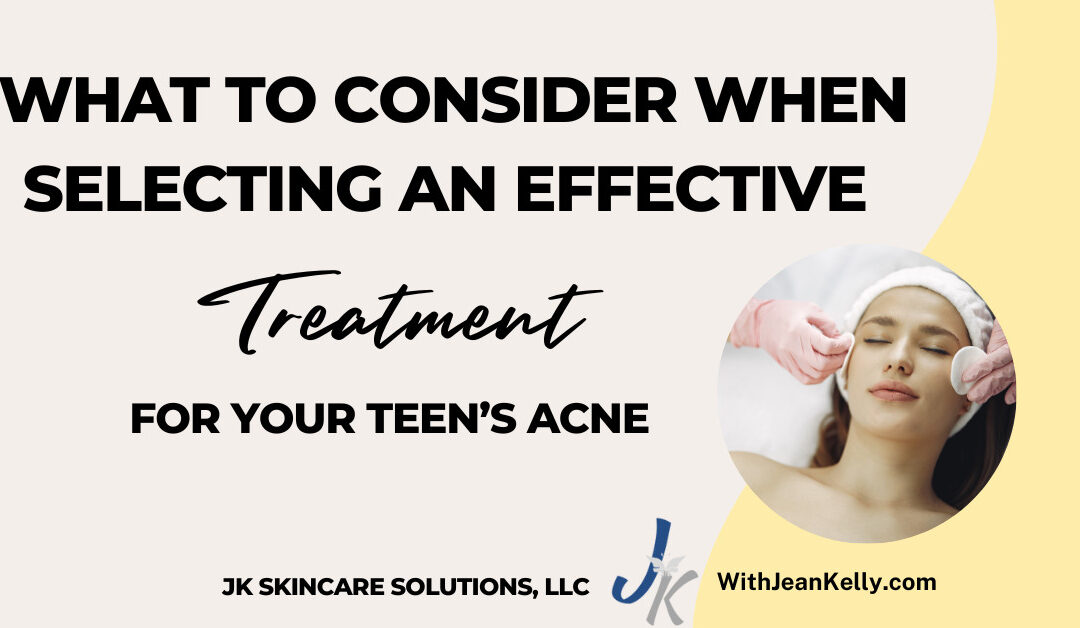 What to Consider When Selecting an Effective Treatment for Your Teen’s Acne