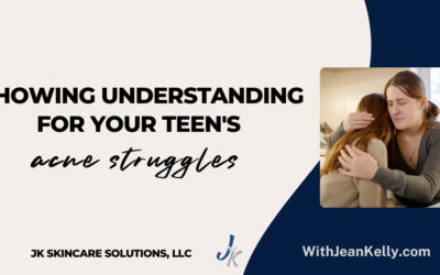Showing Understanding for Your Teen’s Acne Struggles