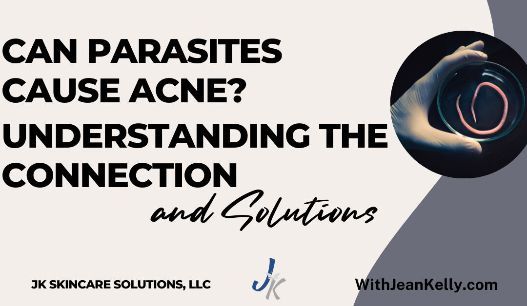 Can Parasites Cause Acne? Understanding the Connection and Solutions