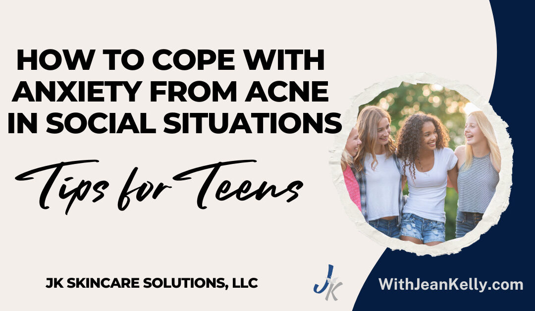 How to Cope with Anxiety from Acne in Social Situations: Tips for Teens