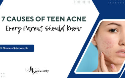 7 Causes of Teen Acne Every Parent Should Know
