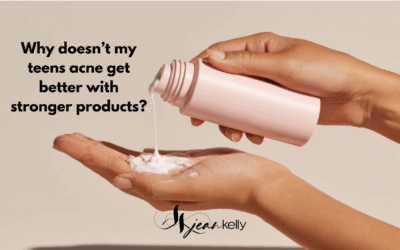Why Doesn’t My Teen’s Acne Get Better With Stronger Products?