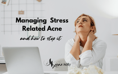 Managing Stress-Related Acne and How To Stop It